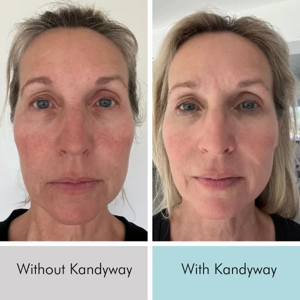 Kandyway Anti Aging Skincare Bundle - Image 3